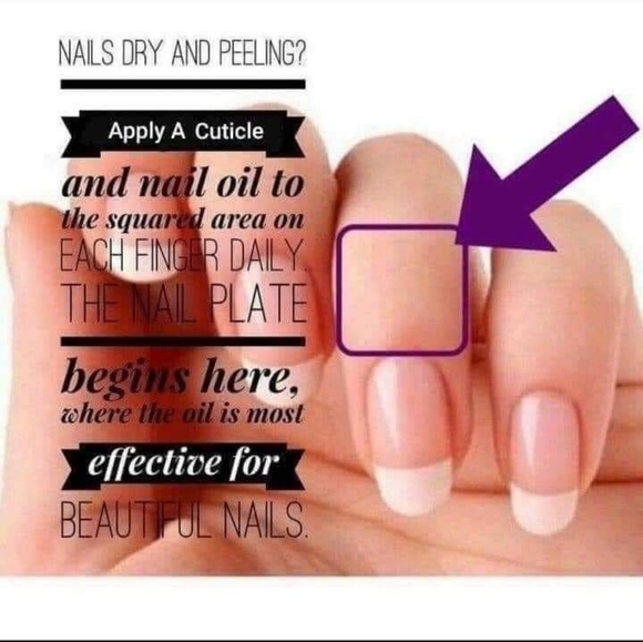 GelMoment - Picture 16 of 16